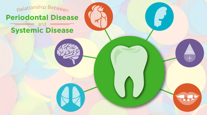 RelationshipBetweenPeriodontalDisease_720x400